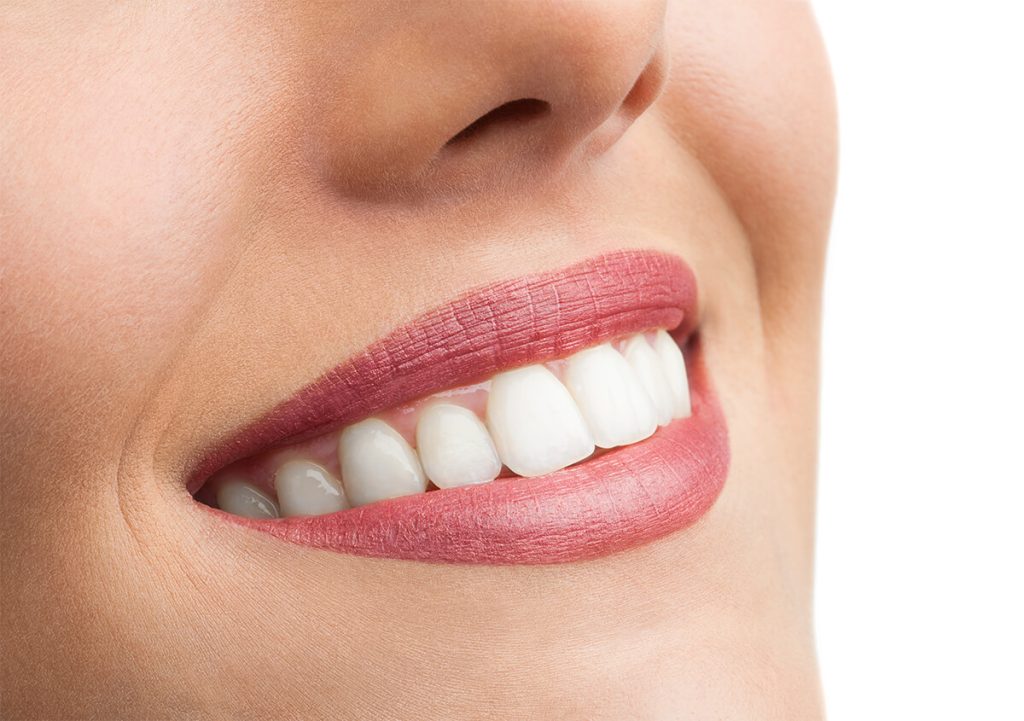 Porcelain Veneers In Austin TX - Cosmetic Dentistry Procedure